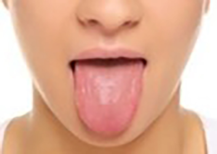 6.　舌クリーニング