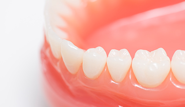 特徴5　「あなたの歯を残せる」の可能性が高まる