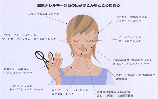 アレルギー 食べ物 金属